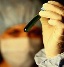 ako sa otestovať na parazity