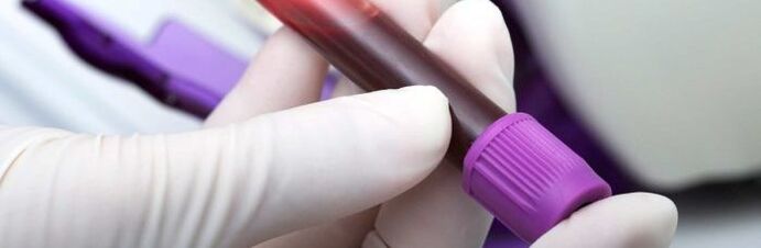 krv na testovanie parazitov
