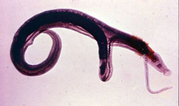 Schistozómy sú jedným z najbežnejších a najnebezpečnejších parazitov